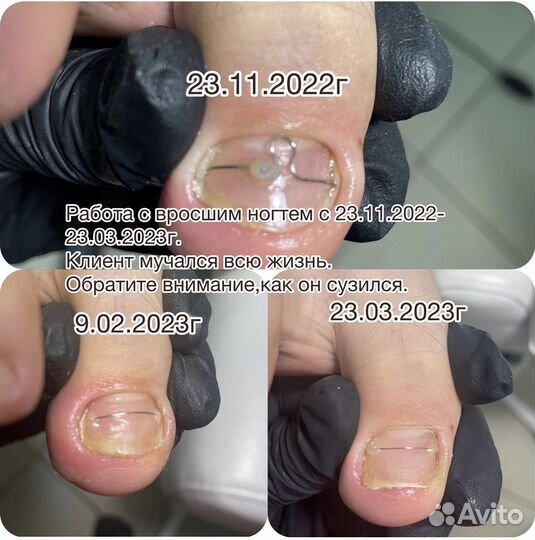 Услуги подолога