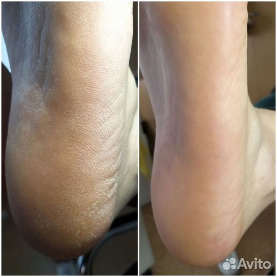 Маникюр,Педикюр