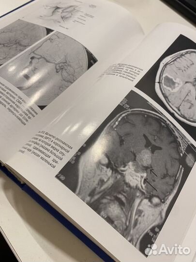 Руководство по неврологии Попп под редакцией Яхно
