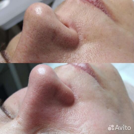 Услуги косметолога