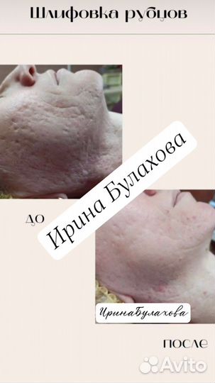 Услуги косметолога