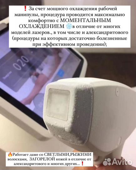 Лазерная эпиляция