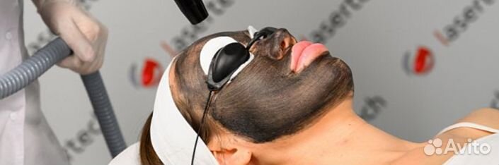 Карбоновый пилинг