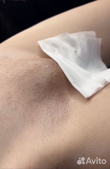 Депиляция/ шугаринг