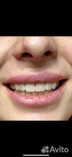 Зуботехническая лаборатория cad-cam центр