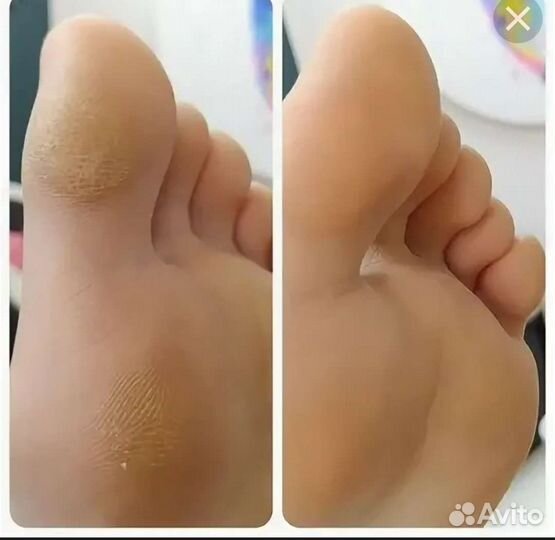 Smart педикюр