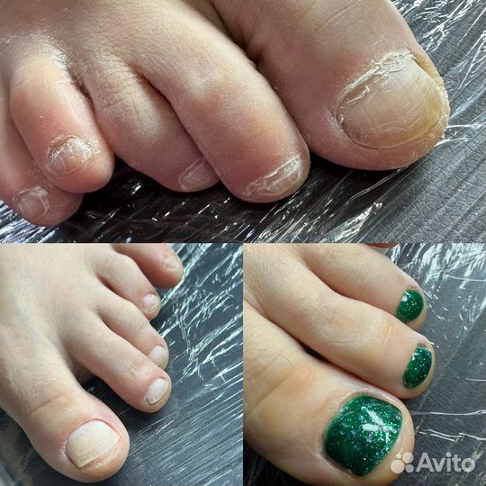 Модель на педикюр