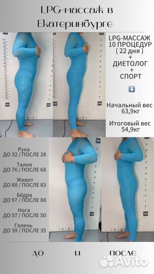 LPG-массаж на оригинальном оборудовании