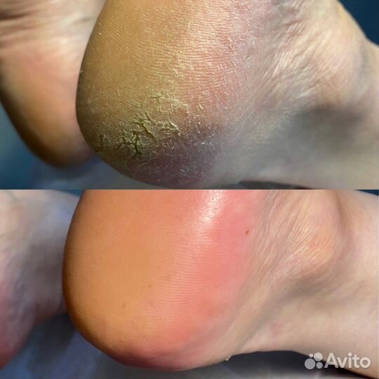 Маникюр, наращивание ногтей, гель-лак, педикюр