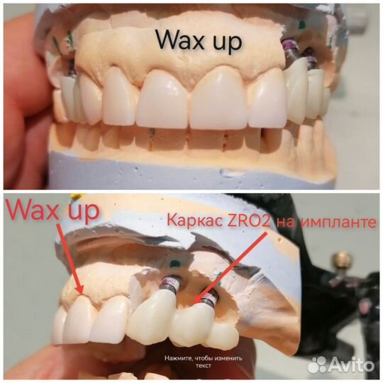 Зуботехнические работы