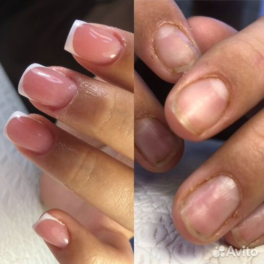 Маникюр педикюр на дому