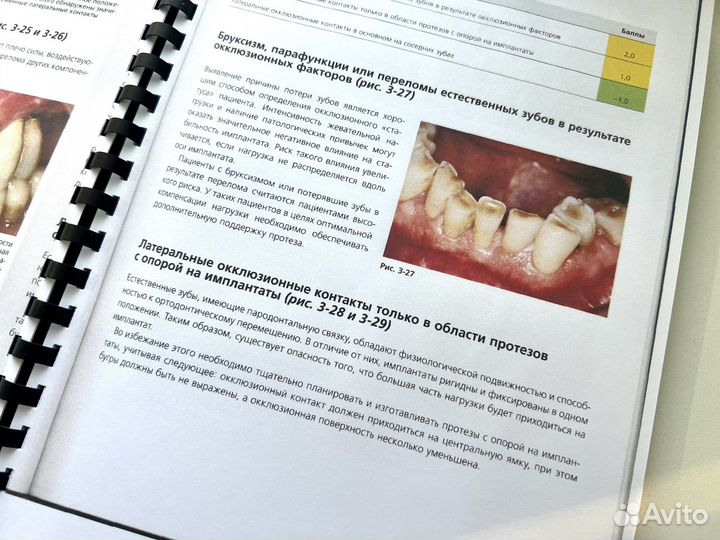Факторы риска в стоматологической имплантологии