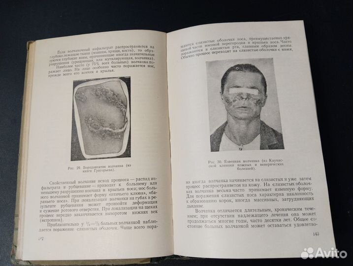 Кожные и венерические болезни, Фандеев, 1954