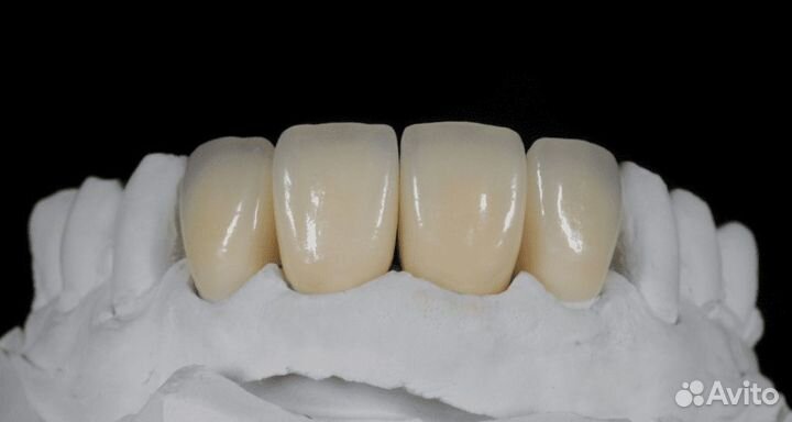 Металлокерамика/Цирконий/Виниры/Съёмные протезы