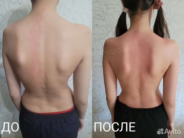 Лечебный массаж