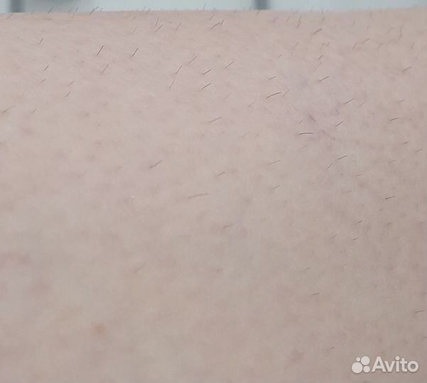 Фотоэпилятор illuminage