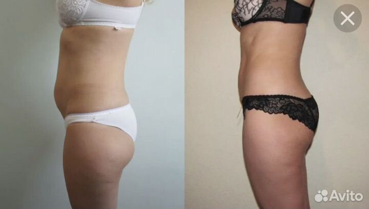 Худей со мной