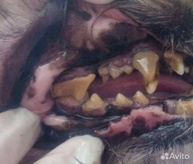 Чистка зубов ультразвуком с выездом на дом