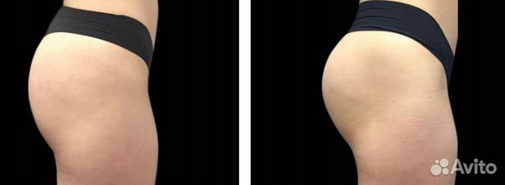 Стройное тело