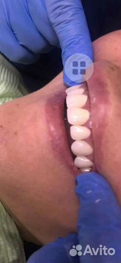 Зуботехническая лаборатория. Зубной Техник