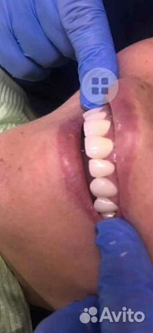 Зуботехническая лаборатория. Зубной Техник