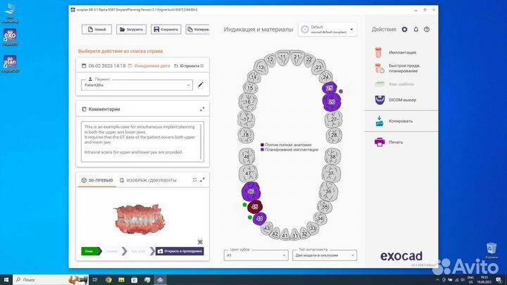 Exoplan Rijeka 3.1 v8587 (2023-07-06 )