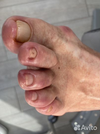 Услуги подолога