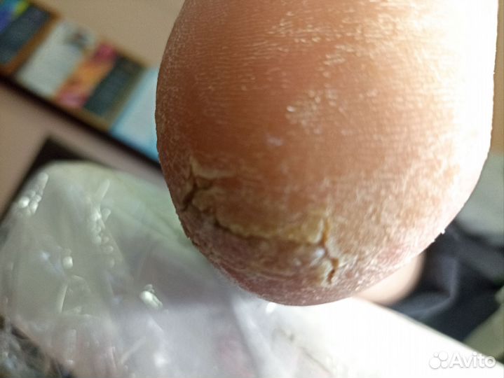 Смарт педикюр