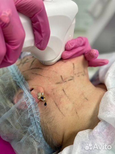 Поставщик косметологического оборудования