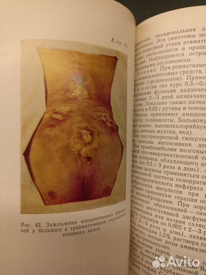 Болезни нервной системы. Ерохина. 1975