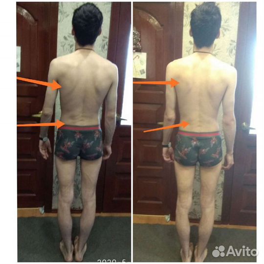 Оздоровление организма (коррекция осанки, работа с