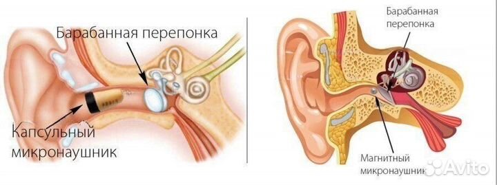 Микрокамера аренда