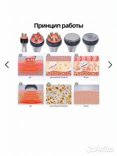 Аппарат 4в1 ; 6в1; 9в1