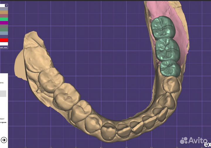 Exocad, exoplan, partialcad последние версии