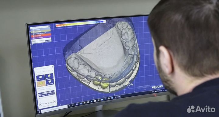 Зубной техник (моделирование CAD-CAM) Краснодар