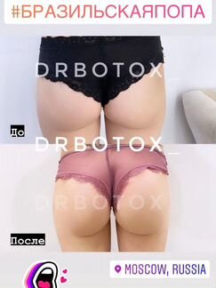 Бразильская попа